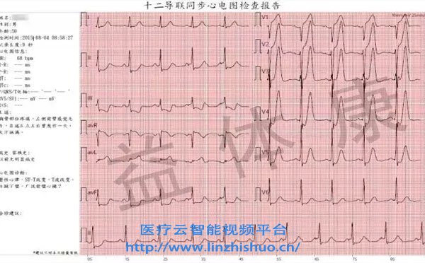 遠(yuǎn)程心電會診系統(tǒng)
